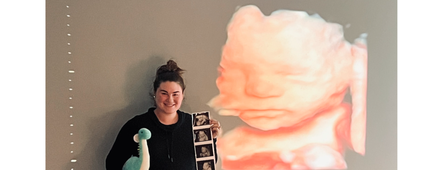 Smiling mom holding ultrasound photos and a stuffed dinosaur beside a large 3D ultrasound image