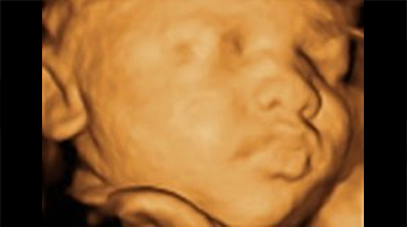 4D ultrasound of a baby resting a hand near the cheek