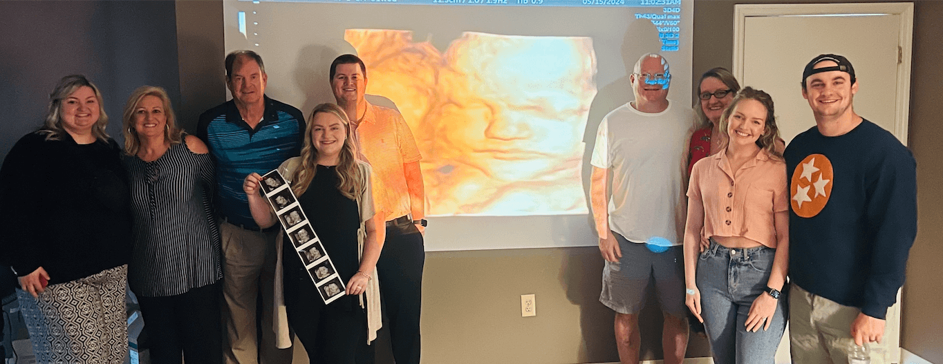 Family smiling in front of a projected 3D ultrasound image of a baby at Toes to Nose